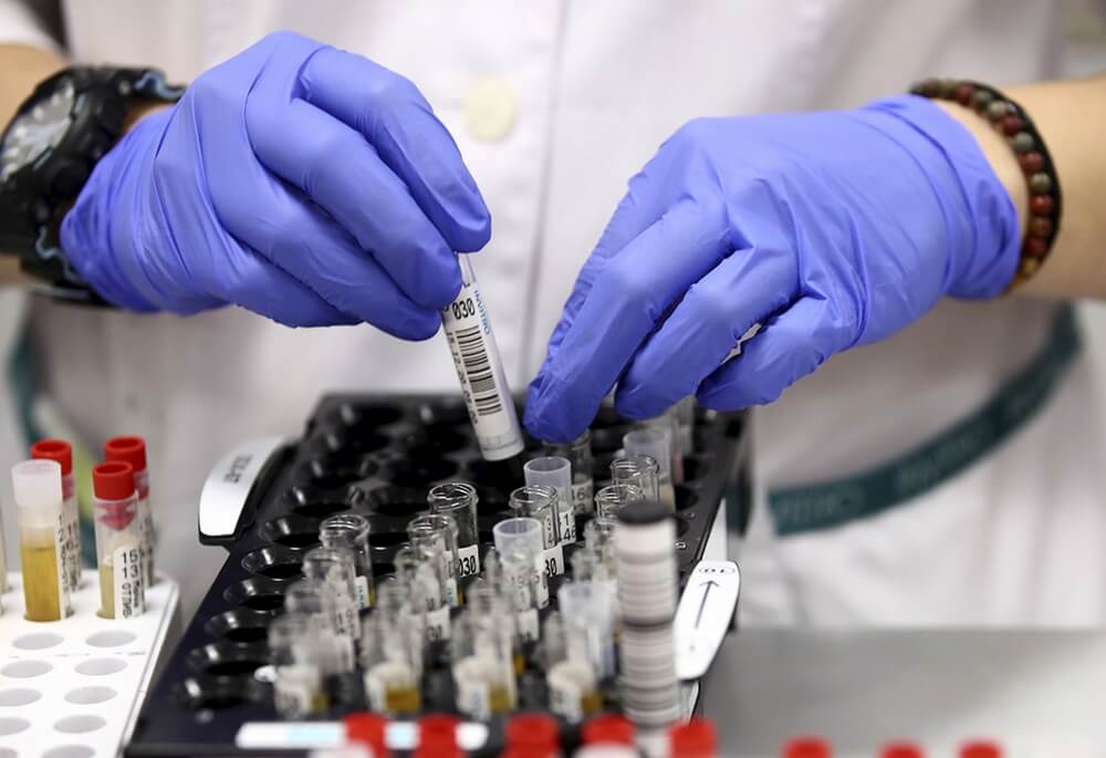 Lab Instrument Rep Covid Testing WHO Delivers to Turkmenistan New Laboratory Equipment For COVID-19 ...